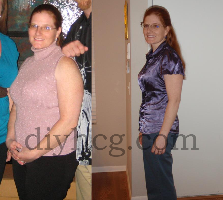 This is Bonnie, she lost 17 pounds in 21 days with the DIY HCG diet... good job girl! 