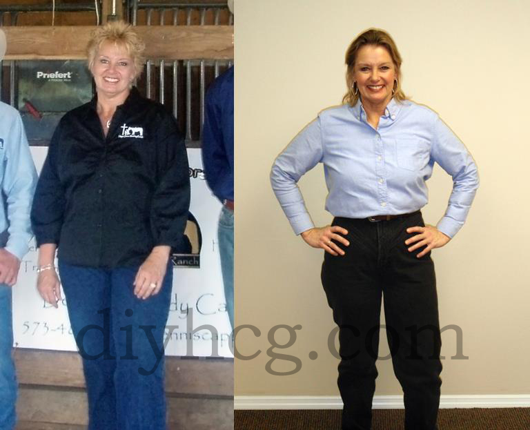 View the full story to this HCG diet before and after story and see TON of more pictures from people who did the HCG diet… amazing results! 
