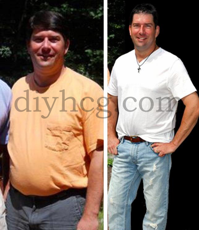 HCG Success Stories Greg's HCG Before and After DoItYourself HCG