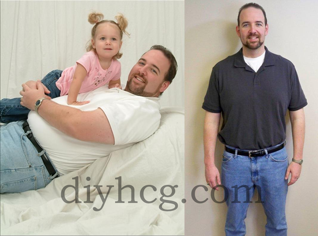 See more HCG before and after pictures on diyhcg.com! These are GREAT!