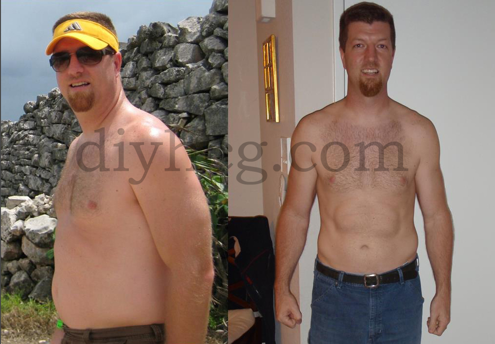 This is Kent, he lost 40 pounds in 1 round of the DIY HCG diet! Awesome job! 