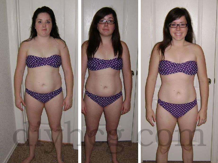 Amazing Weight Loss Stories Before And After
