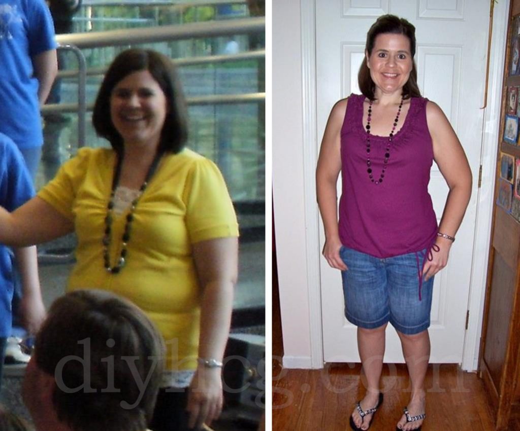 Melanie Rs Hcg Diet Pictures Weight Loss Before And After Do It