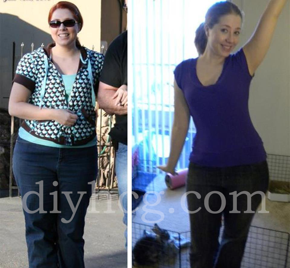 Hcg Success Stories Natasha S Hcg Before And After Do It Hcg Success Stories Natasha S Hcg Before And After Do It