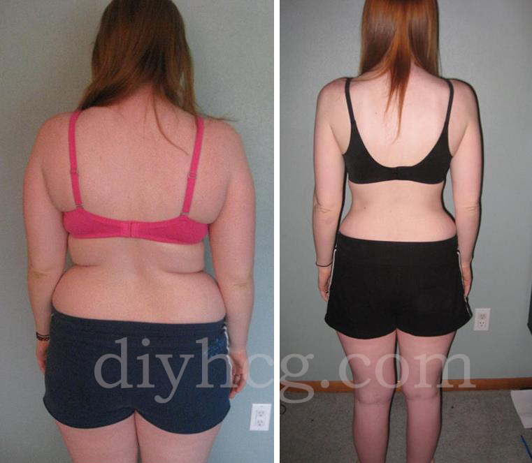 Lost 45 pounds in 7 months with this HCG plan! Wow! She looks amazing!