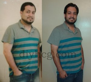 DIY HCG Diet Success Story Photo