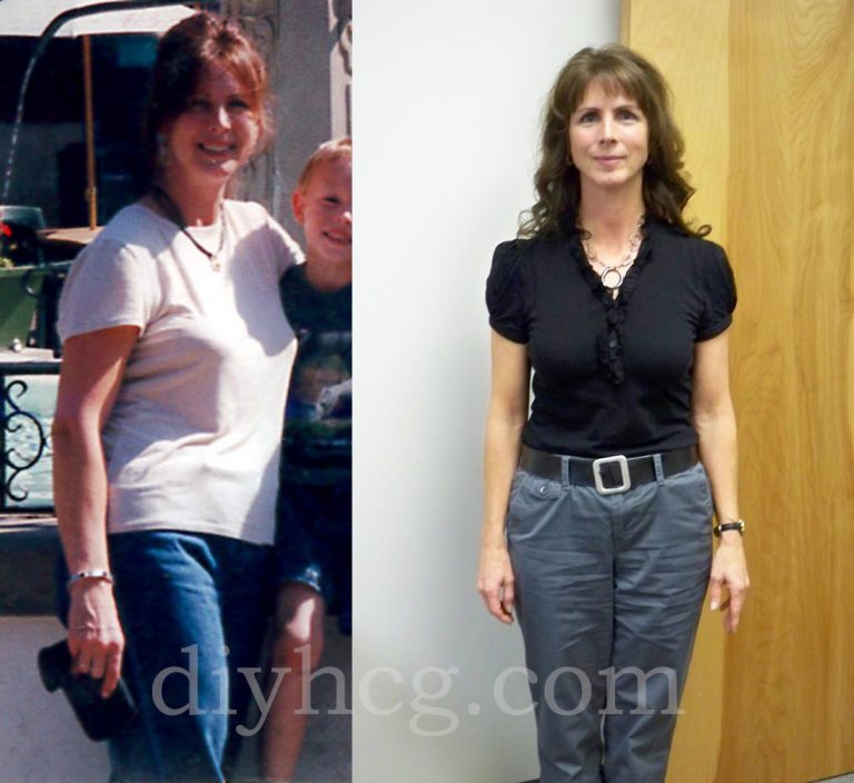HCG Success Stories HCG Before and After
