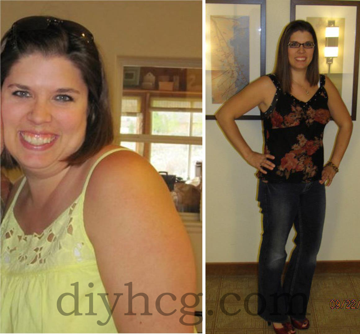 DIY HCG Diet Before and After Photos See Rachael's Success