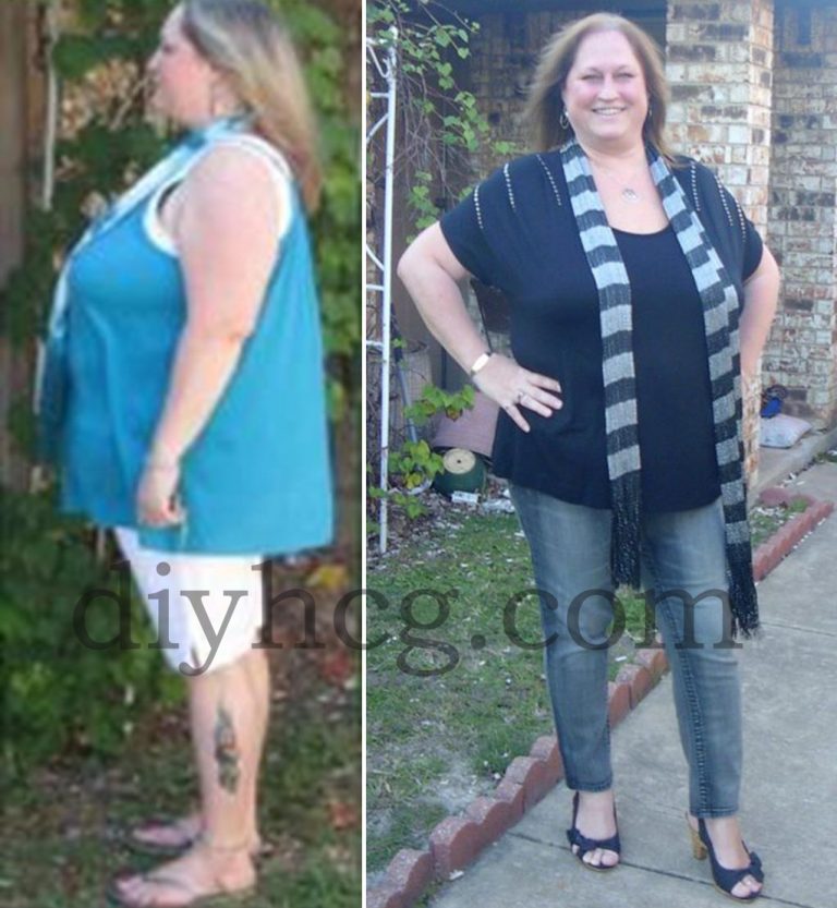 HCG Success Stories Tammy's HCG Before and After