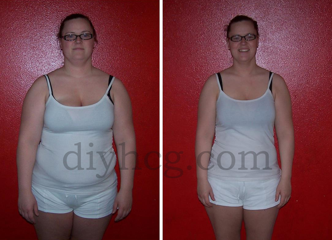 Before and After HCG Story Using Diet Drops